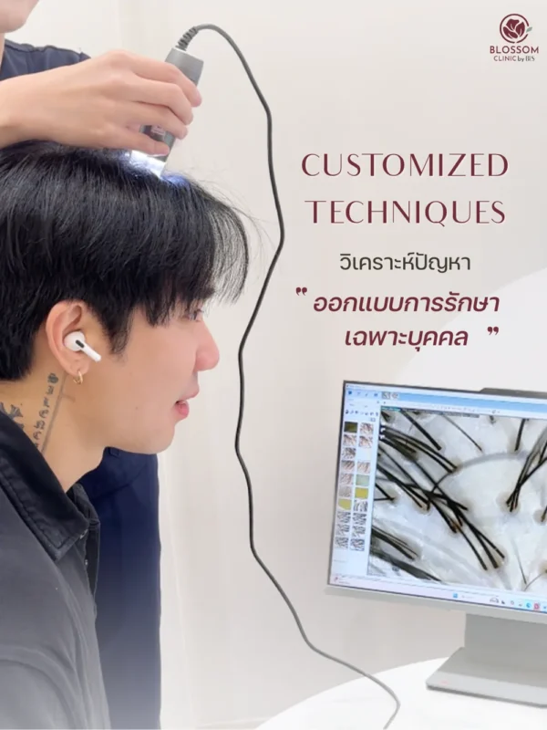 แก้ปัญหาผมร่วง รักษาผมบาง ที่ Blossom Clinic