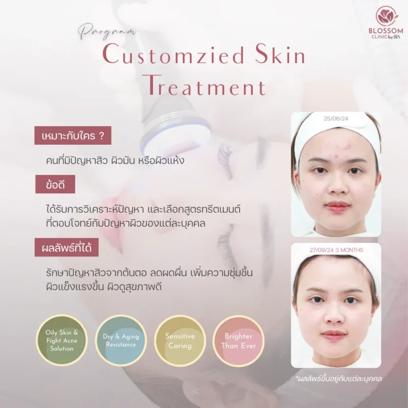 โปรแกรมดูแลผิว Customized Skin Treatment ที่ Blossom Clinic