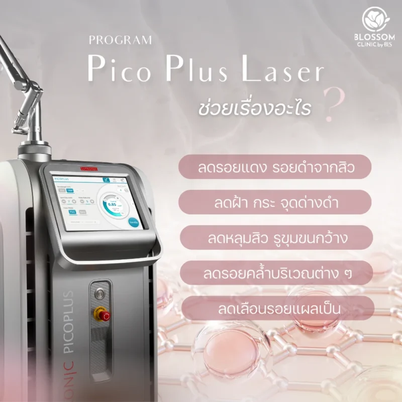 โปรแกรมดูแลผิว ทำเลเซอร์ Picosecond Laser