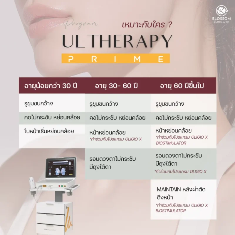 Ulthera Prime เทคโนโลยียกกระชับชั้น SMAS