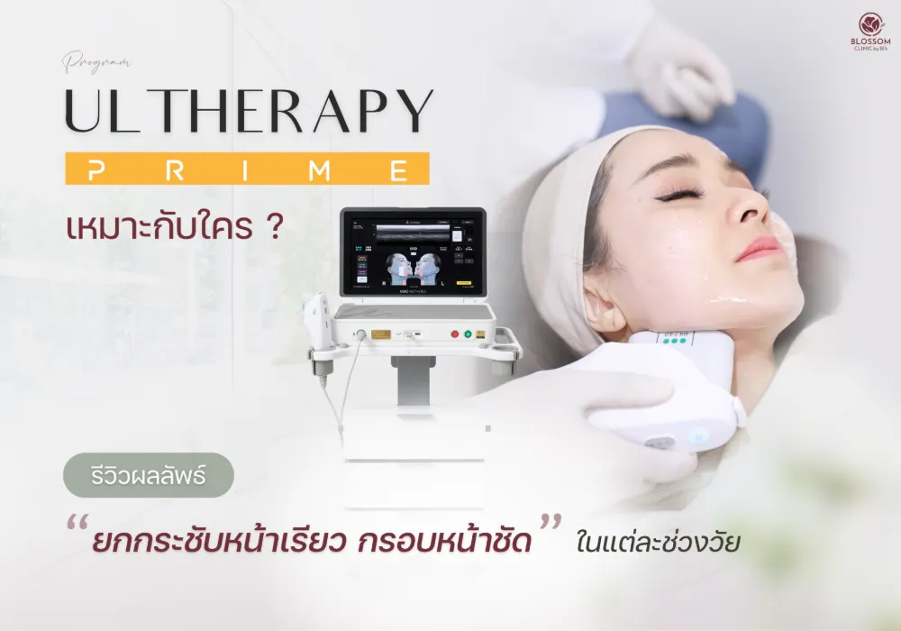 โปรแกรม Ulthera Prime เหมาะกับใคร? รีวิวผลลัพธ์ "ยกกระชับหน้าเรียว กรอบหน้าชัด" ในแต่ละช่วงวัย