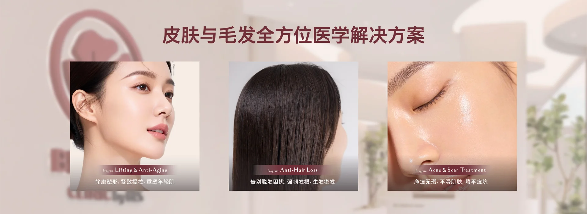 web - cover ch-06