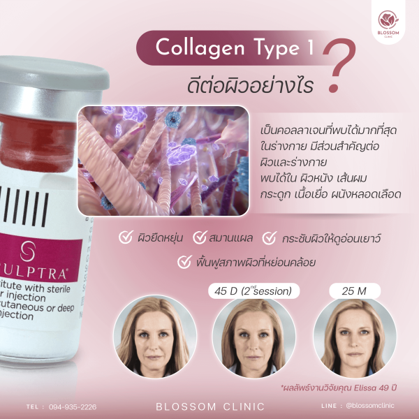 Collagen Type 1 จำเป็นต่อผิวอย่างไร