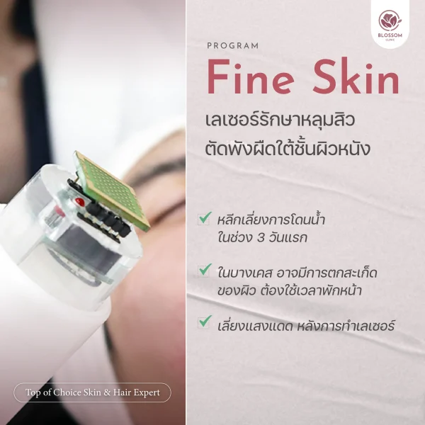 โปรแกรม Fine Skin