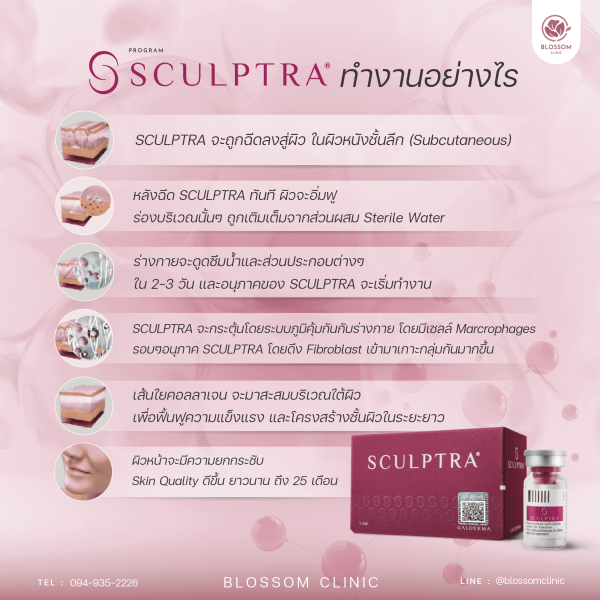 Sculptra ทำงานอย่างไร