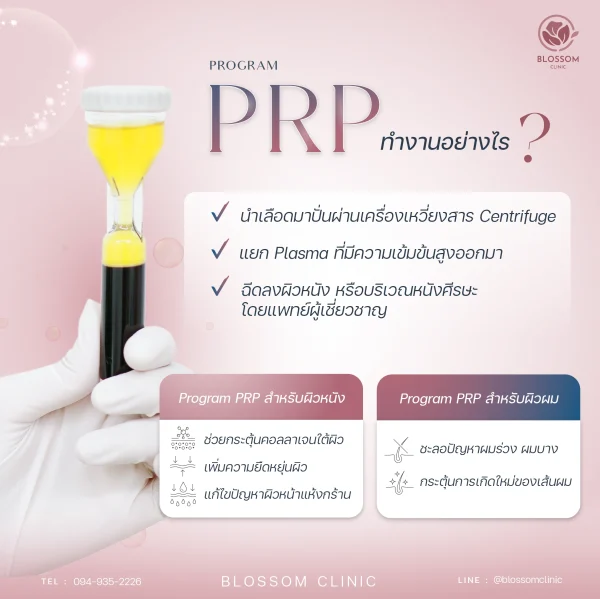 โปรแกรม PRP ฟื้นฟูผิวหน้าและเส้นผมอย่างไร?