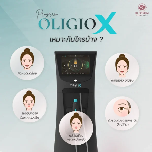 Oligio X ดีไหม เหมาะกับใครบ้าง
