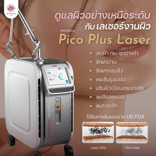 โปรแกรม Pico Laser คือ เลเซอร์ฝ้า กระ จุดด่างดำ