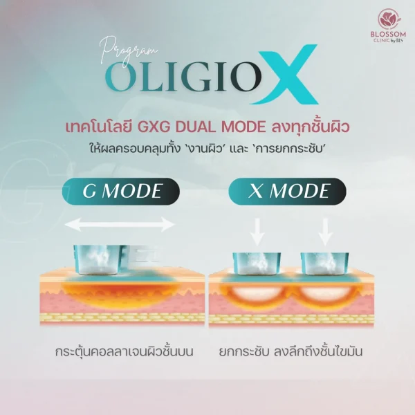 โปรแกรม Oligio X Wontech มีข้อดีอย่างไร