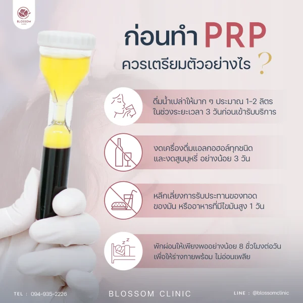 เตรียมตัวก่อนทำ PRP