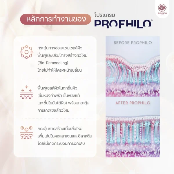 หลักการทำงานของ Profhilo