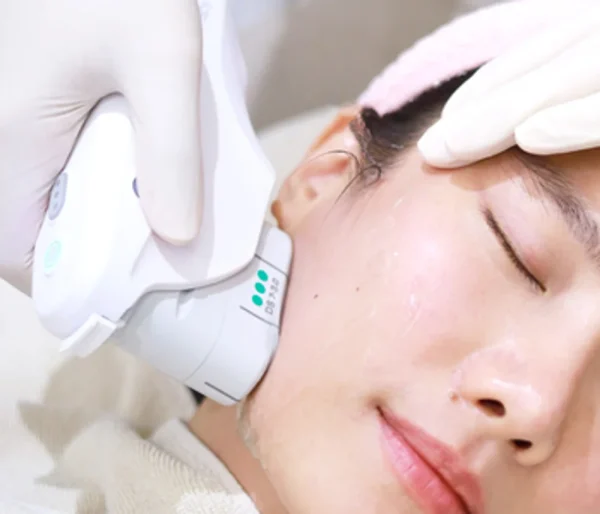 รีวิว โปรแกรม Ulthera Prime จากผู้ที่เคยใช้บริการ