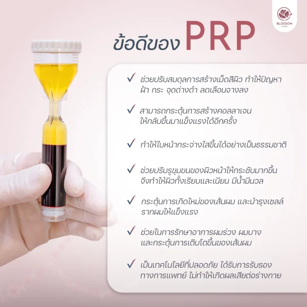 PRP ช่วยในเรื่องอะไรได้บ้าง?
