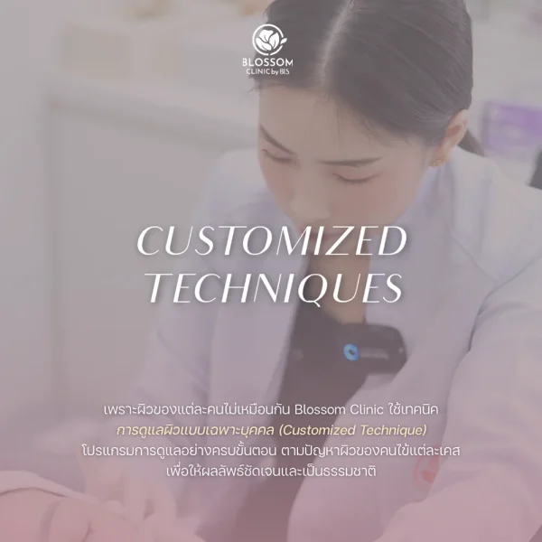 Customized Technique คืออะไร