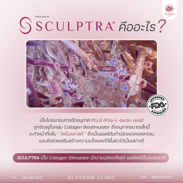 Sculptra คืออะไร