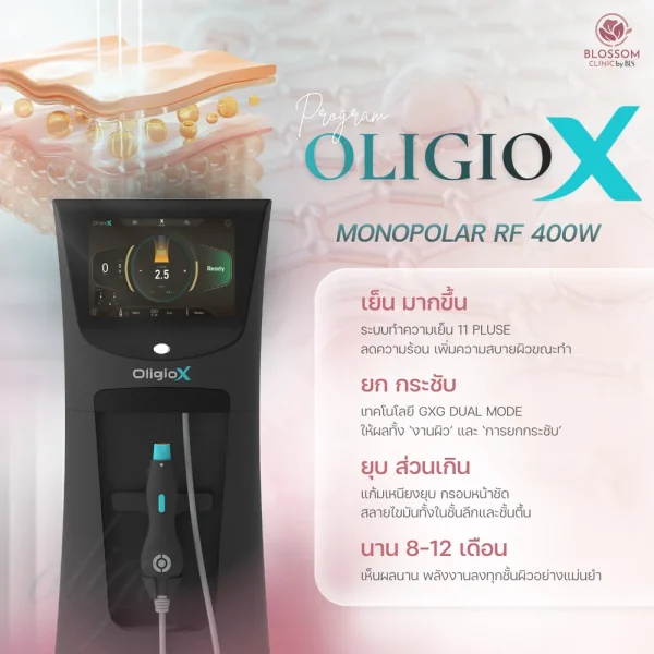 โปรแกรม Oligio X คืออะไร ช่วยอะไร