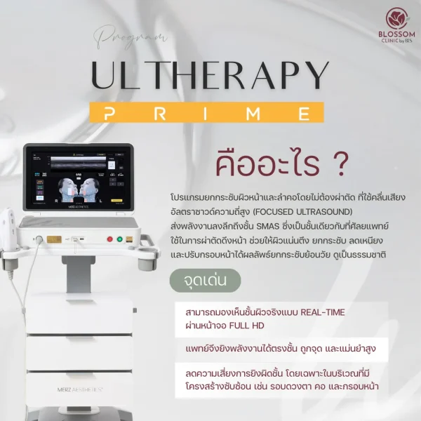 Program Ulthera Prime คืออะไร และทำงานอย่างไร