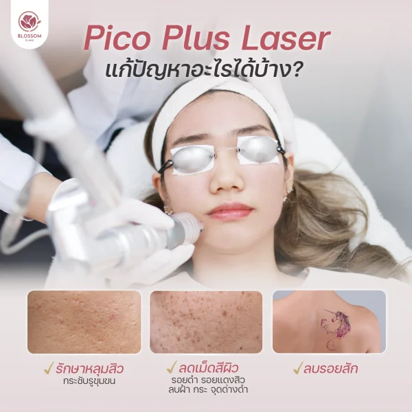 โปรแกรม Pico Laser แก้ปัญหาอะไรได้บ้าง